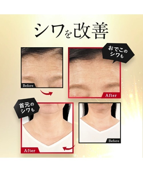 PERFECT ONE（パーフェクトワン） オールインワン 薬用リンクル